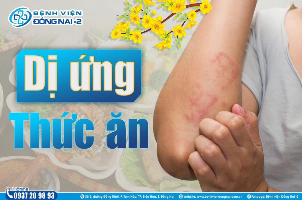 Dị ứng thực phẩm gây ngứa, khó thở, nguy hiểm hơn có thể dẫn đến tử vong