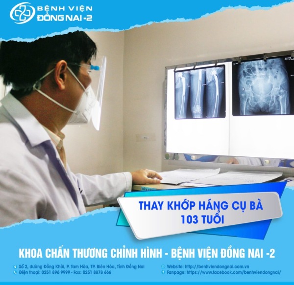 Thay khớp háng tại BV Đồng Nai-2 rất an toàn, hiệu quả, phục hồi vận động