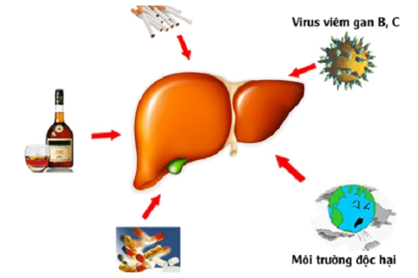 Bệnh gan có thể phát sinh từ nhiều nguyên nhân