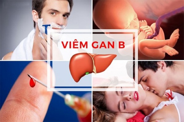 Hiểu rõ con đường lây nhiễm virus HBV để chủ động phòng tránh