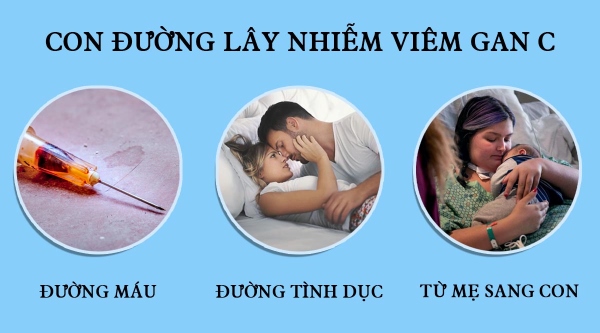 Bệnh viêm siêu vi gan C lây qua 3 đường chính