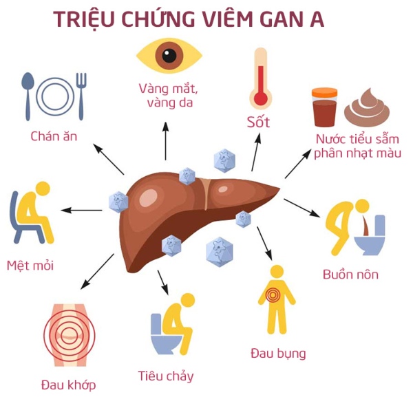 Các triệu chứng của bệnh