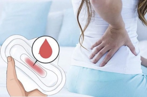 Ra máu như hành kinh khi mang thai tháng đầu và các dấu hiệu nhận biết