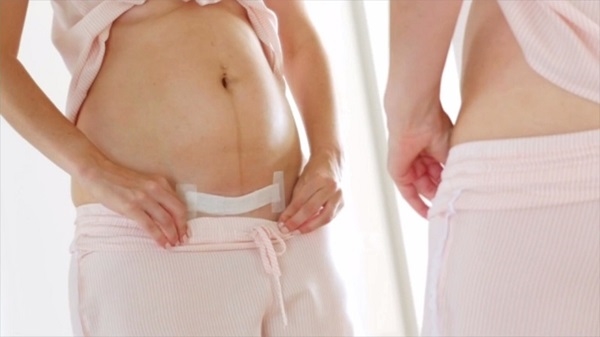 Thay băng gạc thường xuyên và tránh tiếp xúc với nước bẩn