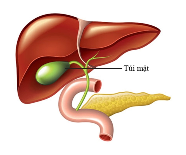 Vị trí của sỏi túi mật