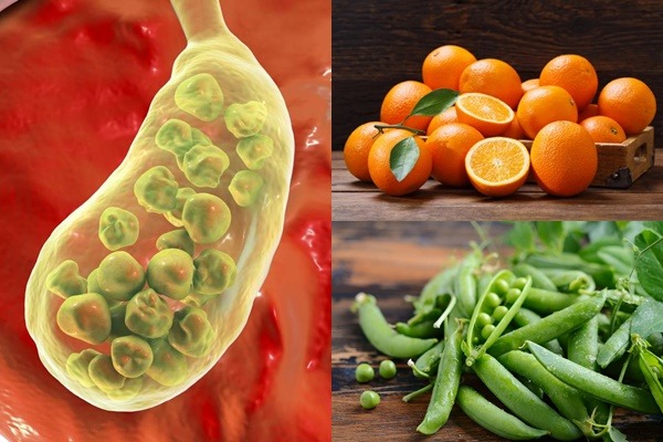 Bổ sung thực phẩm giàu chất xơ, vitamin C để phòng ngừa sỏi túi mật
