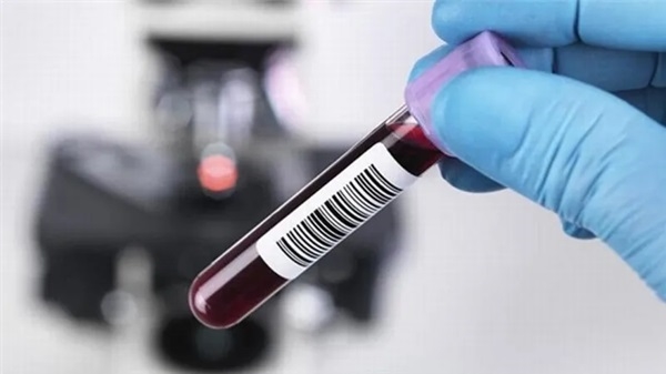 Xét nghiệm máu là cách chẩn đoán Anti-HAV nhanh nhất
