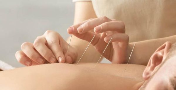Châm cứu chữa đau vai gáy được biết đến là phương pháp y học cổ truyền hiệu quả