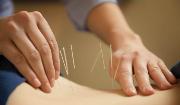 Các lưu ý khi châm cứu chữa đau vai gáy