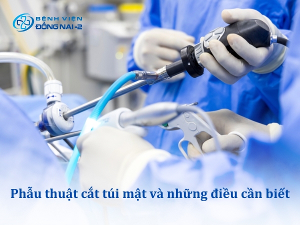 Phẫu thuật cắt túi mật và những điều cần biết