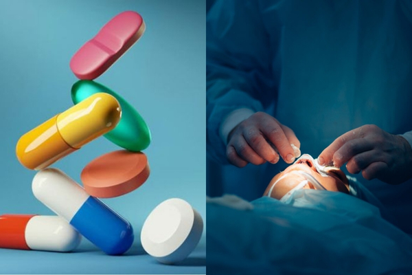 Điều trị viêm xoang mũi dị ứng bằng thuốc hoặc phẫu thuật