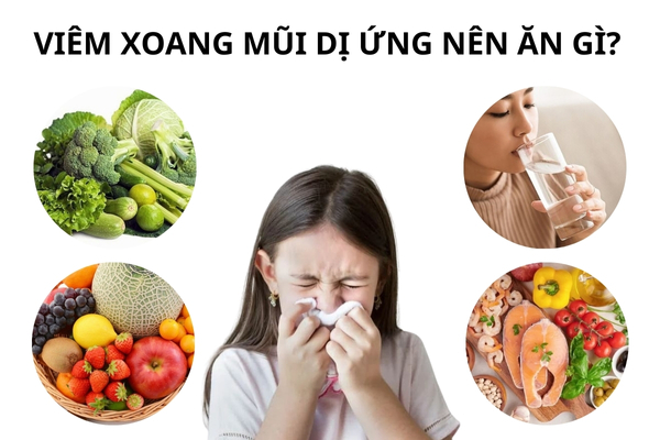Nên và không nên ăn gì khi bị viêm xoang mũi dị ứng?