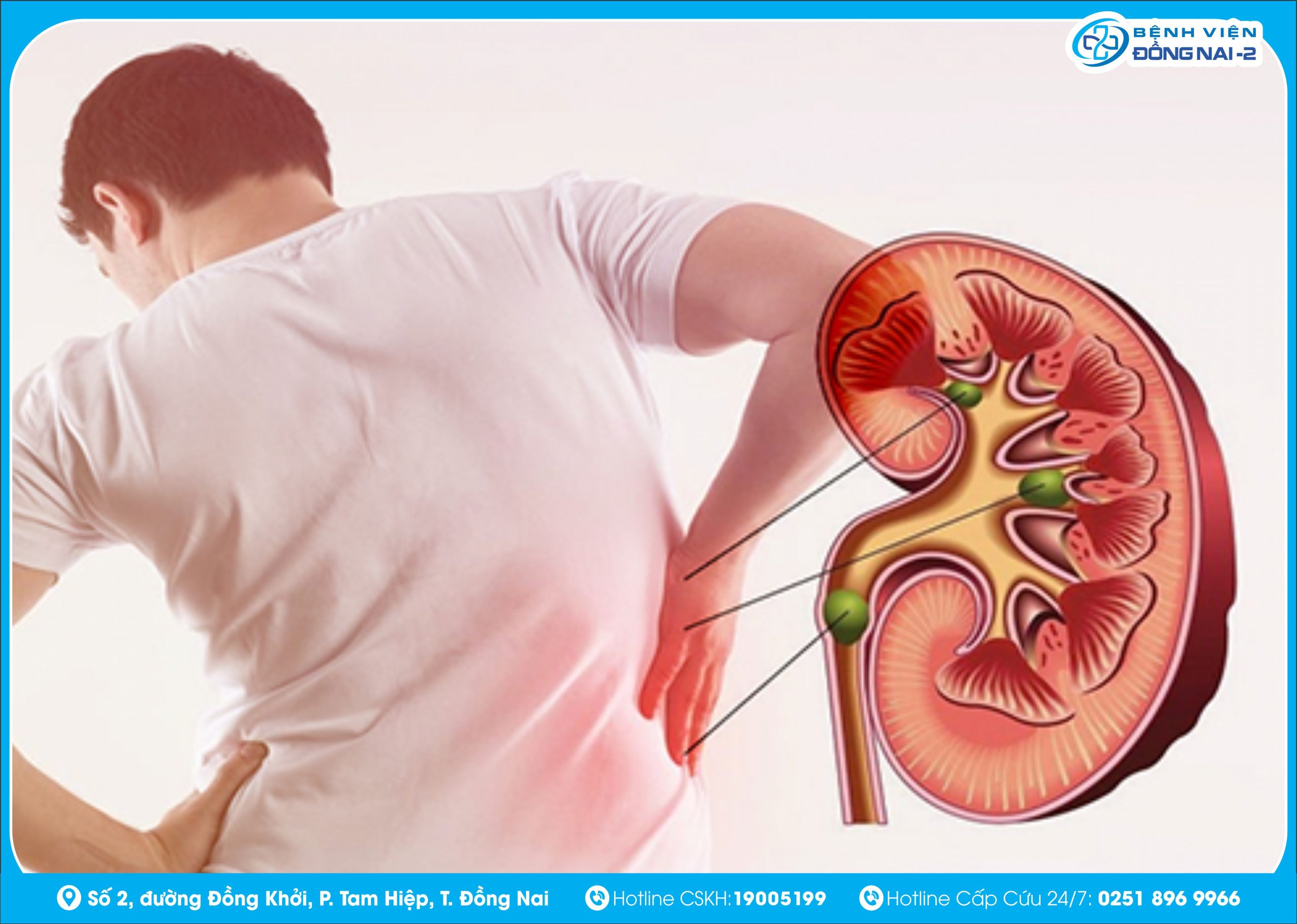 Sỏi thận vẫn có thể tái phát nếu người bệnh không giữ chế độ ăn uống và sinh hoạt lành mạnh