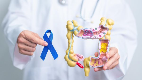 Cắt polyp đại tràng có nguy hiểm không? Các lưu ý gì sau khi cắt 