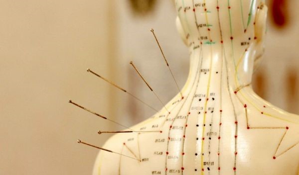 Đau vai gáy là tình trạng phổ biến, đặc trung bởi cảm giác vùng cổ gáy bị co cứng