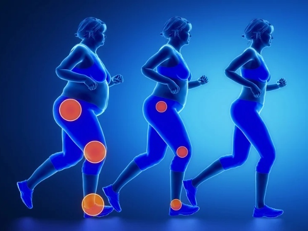 Thừa cân có thể tạo ra áp lực lớn lên gối, gây đau nhức khớp