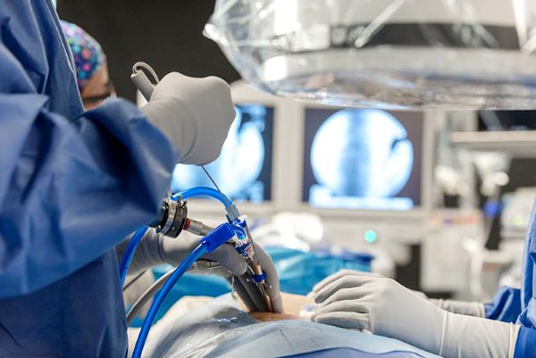 Các triệu chứng sớm của thoát vị đĩa đệm