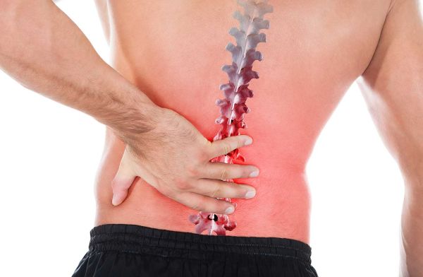 Thời điểm nên mổ thoát vị đĩa đệm