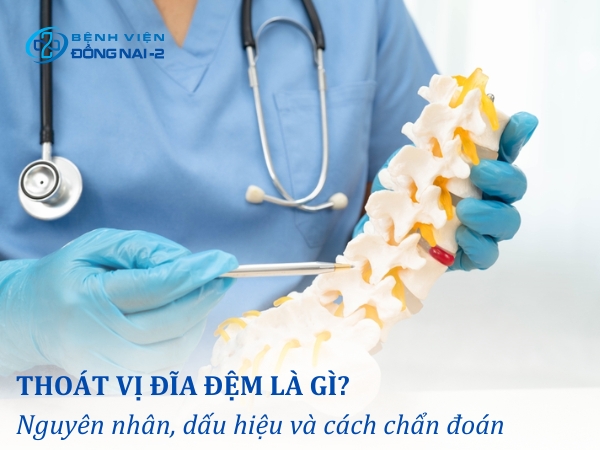 Thoát vị đĩa đệm là gì?