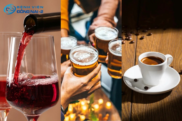 Rượu bia và caffeine liều cao gây đau đầu, buồn nôn, khát nước, mệt mỏi kéo dài