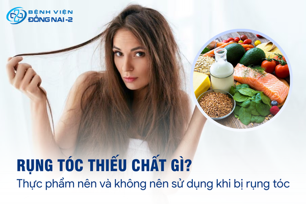 Rụng tóc thiếu chất gì? Thiếu hụt vi chất dinh dưỡng là nguyên nhân phổ biến thường bị bỏ qua