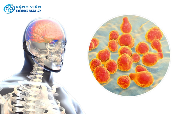 Viêm não, viêm màng não là tình trạng cấp tính nguy hiểm cần được cấp cứu ngay lập tức