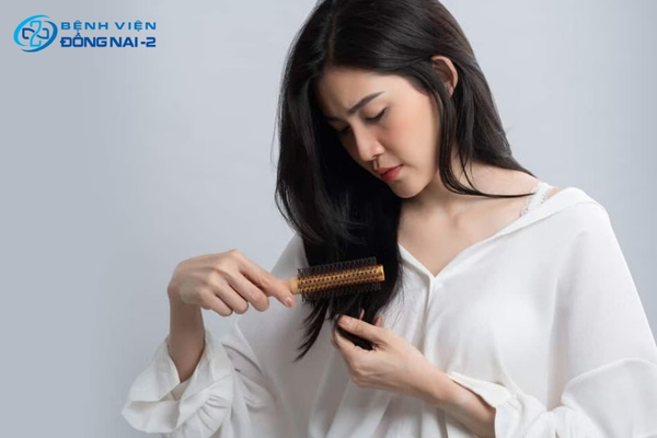 Triệu chứng tóc rụng nhiều bao gồm: tóc rụng thành mảng, chân tóc thưa dần, gãy rụng khi gội chải