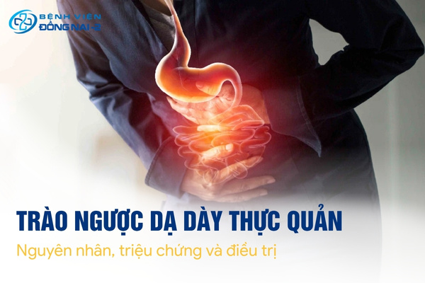 Trào ngược dạ dày thực quản xảy ra khi cơ thắt thực quản dưới suy yếu
