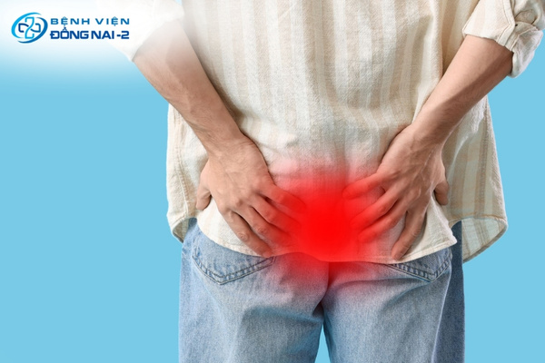 Triệu chứng điển hình của bệnh trĩ: chảy máu khi đi tiêu, ngứa hậu môn, đau và khối lồi ra ngoài