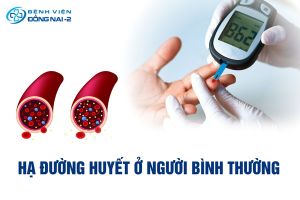 Hạ đường huyết ở người bình thường có thể xảy ra với bất kỳ ai