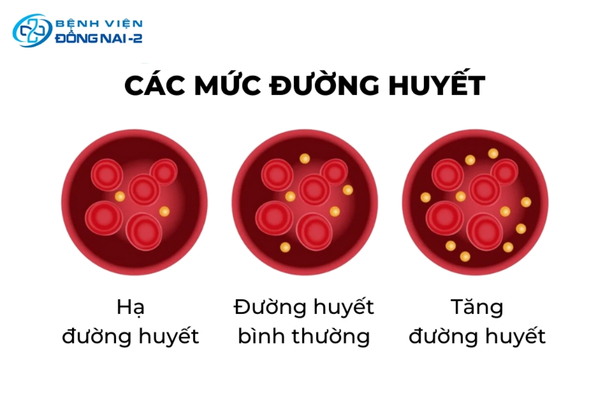 Hạ đường huyết xảy ra khi nồng độ glucose trong máu giảm xuống dưới mức cần thiết