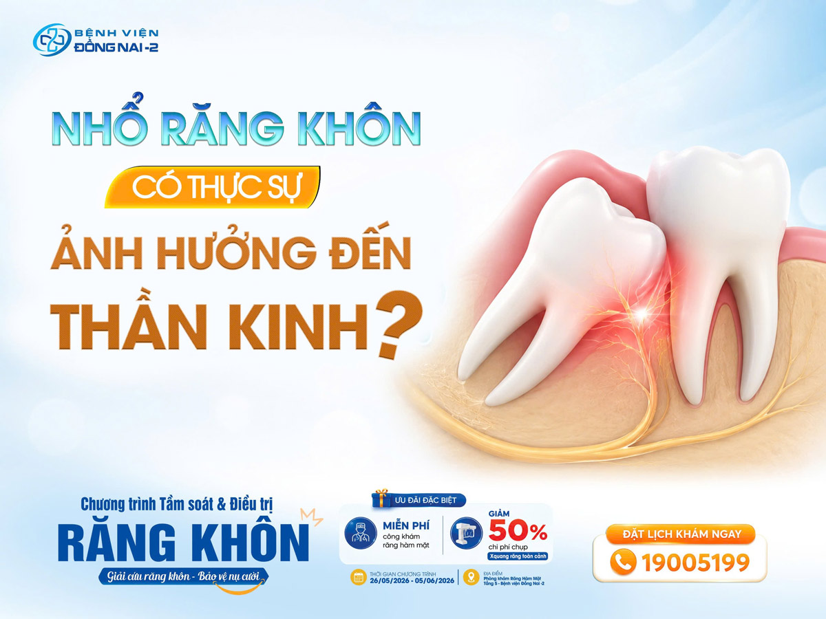 Nhổ răng khôn có thực sự ảnh hưởng đến thần kinh