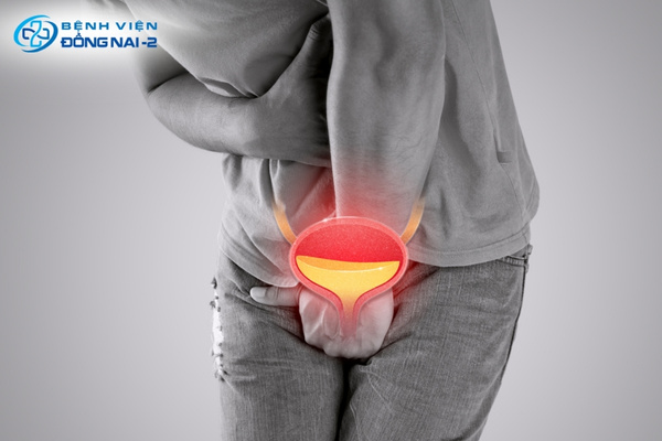 Tiểu buốt sẽ không tự khỏi nếu liên quan đến bệnh lý nhiễm khuẩn hoặc sỏi tiết niệu