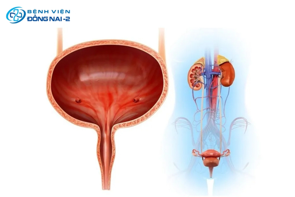 Viêm bàng quang biểu hiện điển hình qua tiểu buốt, tiểu rắt và tiểu ra máu
