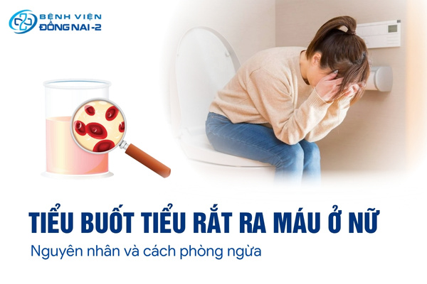 Tiểu buốt tiểu rắt ra máu ở nữ là dấu hiệu cảnh báo nhiều bệnh lý cần được thăm khám kịp thời