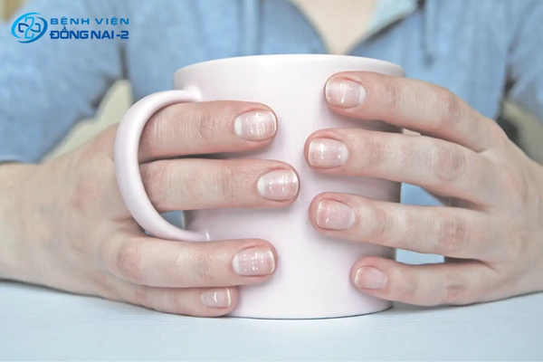 Móng tay yếu, dễ gãy phản ánh tình trạng cơ thể đang thiếu hụt canxi