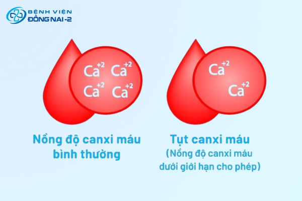 Hình ảnh nồng độ canxi máu bình thường và hạ canxi máu