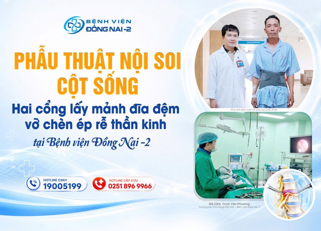 Phẫu thuật nội soi cột sống UBE điều trị thoát vị đĩa đệm